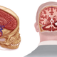 Artist’s depiction of RFK’s injuries.